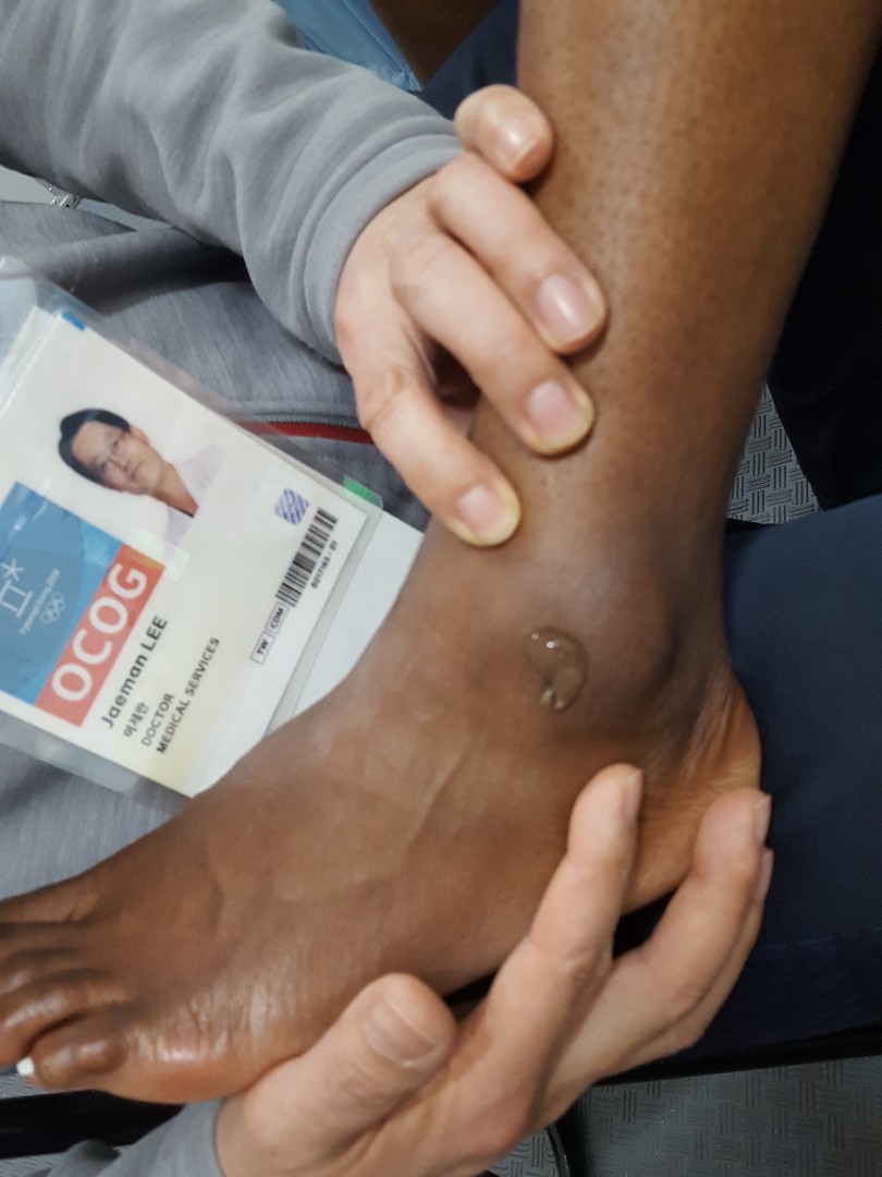 0aa5ead870dbb194877627d4a693dc54_1522141